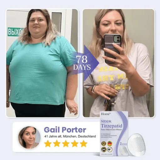 𝗛𝗼𝗻𝘅𝗶® 𝗡𝗜𝗗𝗗𝗞-𝗧𝗶𝗿𝘇𝗲𝗽𝗮𝘁𝗶𝗱 𝗡𝗮𝗻𝗼-𝗠𝗶𝗸𝗿𝗼𝗻𝗮𝗱𝗲𝗹-𝗣𝗳𝗹𝗮𝘀𝘁𝗲𝗿
