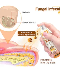 Cvreoz™ Bee Venom Nail Fungus Spray
