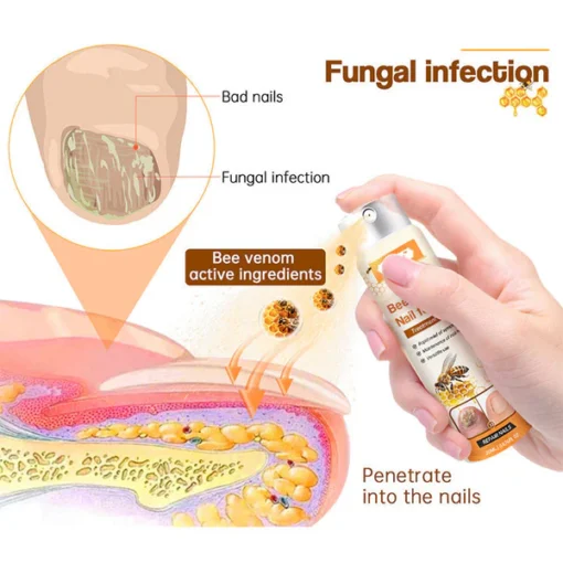 Cvreoz™ Bee Venom Nail Fungus Spray