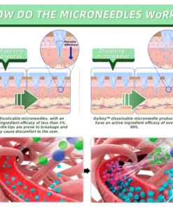 Lenreey® SMGT-GlP-1 Nano Microneedle Essence