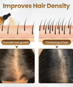 LOVILDS™ Hair Revival Growth Serum
