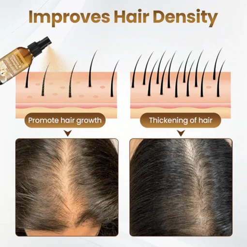 LOVILDS™ Hair Revival Growth Serum