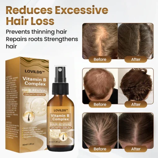 LOVILDS™ Hair Revival Growth Serum