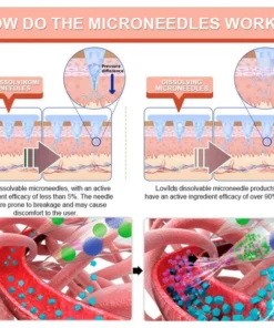 Lovilds® SMGT-GLP-1 Nano Microneedle Patch