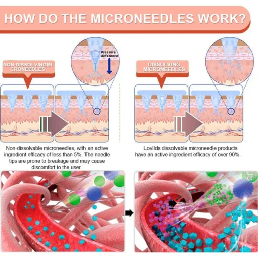 Lovilds® SMGT-GLP-1 Nano Microneedle Patch