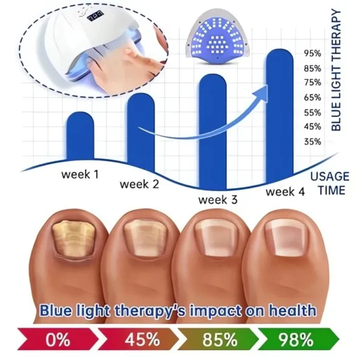 PureNail Fungus Laser Therapy Device
