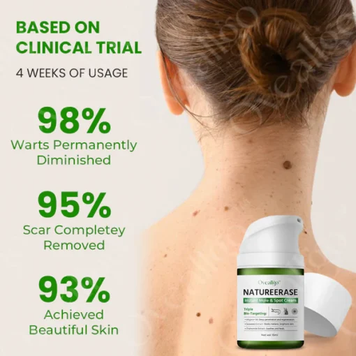 Oveallgo™ EXTRA NatureErase Instant Mole & Spot Cream