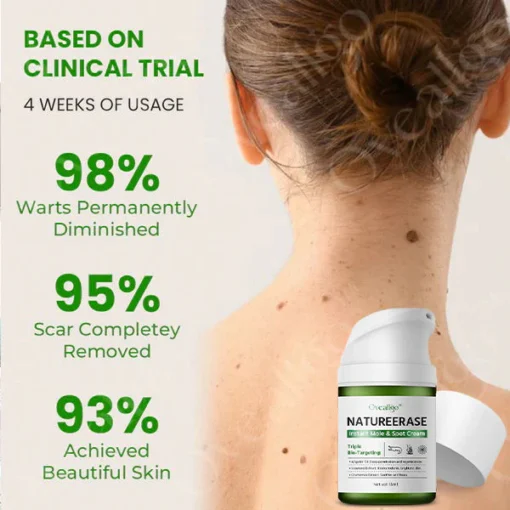 Official Store: Oveallgo® NatureErase Instant Mole & Spot Cream