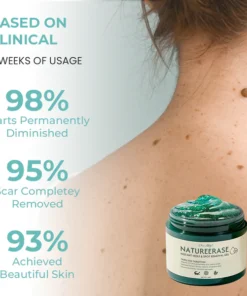 Oveallgo® NatureErase Gel zur sofortigen Entfernung von Muttermalen und Flecken