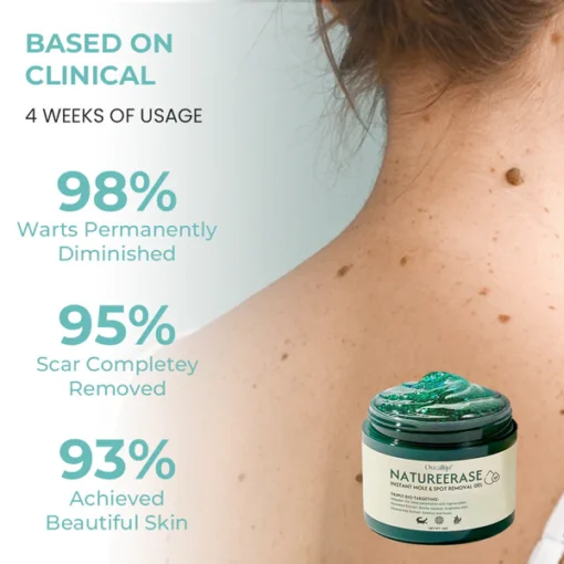 Oveallgo® NatureErase Gel zur sofortigen Entfernung von Muttermalen und Flecken
