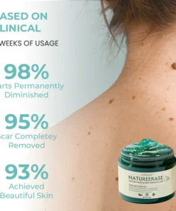 LOVILDS™ NatureErase Instant Mole & Spot Removal Gel