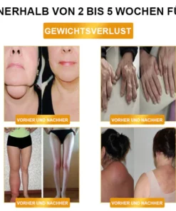 LOVILDS™ Ultrasonic Fat Blasting