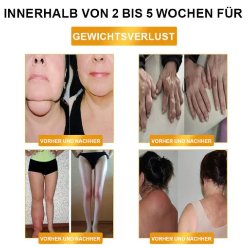 LOVILDS™ Ultrasonic Fat Blasting