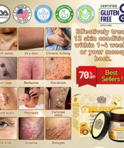 LOVILDS™ Bee Essence Skin Antibacterial Cream