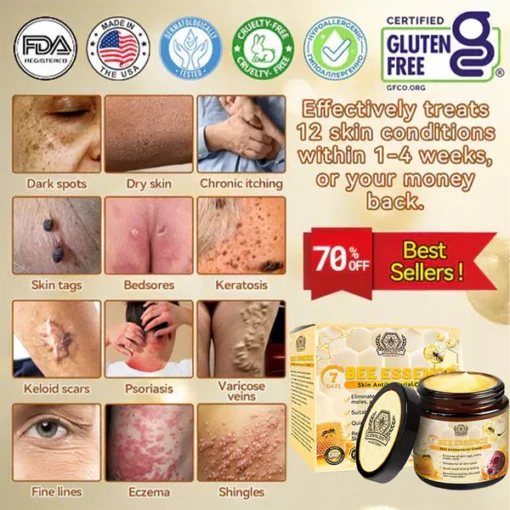 LOVILDS™ Bee Essence Skin Antibacterial Cream