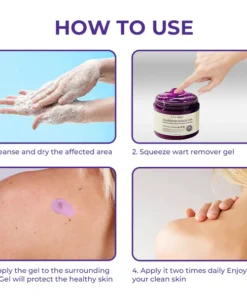 Oveallgo® Clarivine Dissolver Mole & Dark Spot Removal Bio-Gel