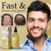 Dobshow™ Rosemary Hair Growth Serum