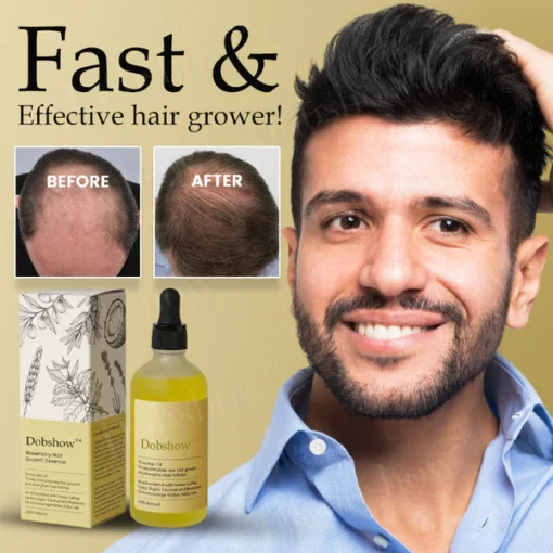 Dobshow™ Rosemary Hair Growth Serum