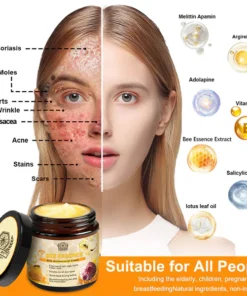 LOVILDS™ Bee Essence Skin Antibacterial Cream
