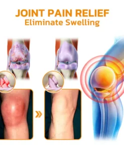 LOVILDS™ Bee poison Pain-Relief Bone Healing Cream