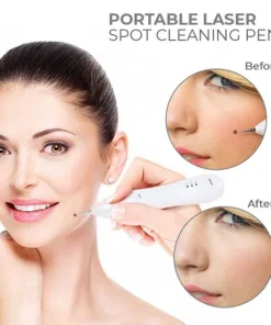 Fivfivgo™ Portable Laser Spot Cleaning Pen