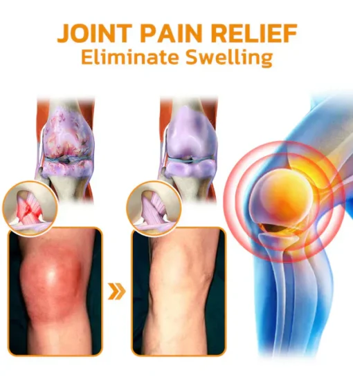 Cvreoz® Bee-Venom Pain-Relief Bone Healing Cream