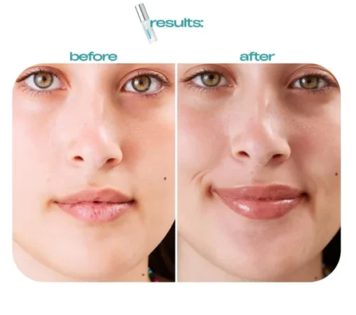 Spicule Plumping Lip Shot