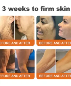 Flysmus™ Botox Bee Venom Firming Serum Stick