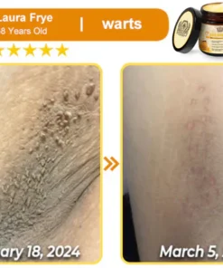 LOVILDS™ Bee Essence Skin Antibacterial Cream