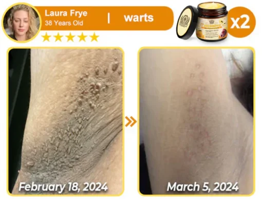 LOVILDS™ Bee Essence Skin Antibacterial Cream