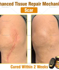 Oxford University Hospital Dermatology Recommendations