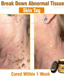 Oxford University Hospital Dermatology Recommendations
