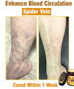 Oxford University Hospital Dermatology Recommendations