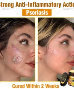 Oxford University Hospital Dermatology Recommendations
