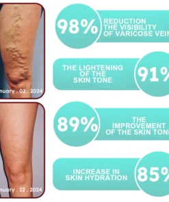 LOVILDS™Leech Varicose Veins Patch