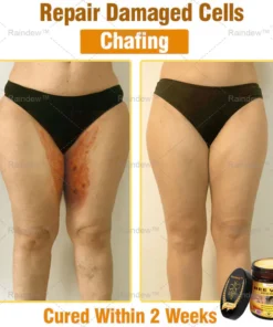 Oxford University Hospital Dermatology Recommendations