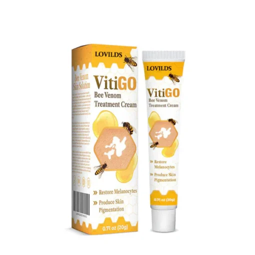 Vitiligo Treatment Cream