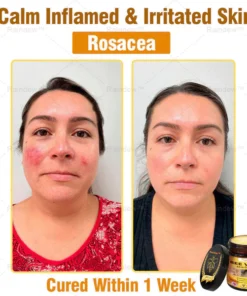 Oxford University Hospital Dermatology Recommendations