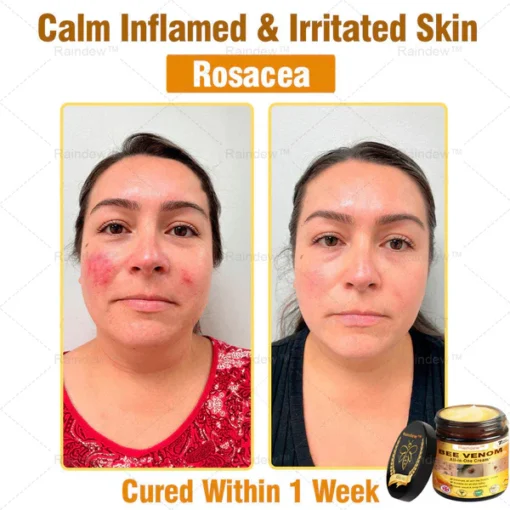 Oxford University Hospital Dermatology Recommendations