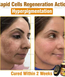 Oxford University Hospital Dermatology Recommendations