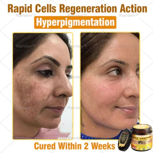 Oxford University Hospital Dermatology Recommendations