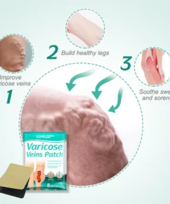 LOVILDS™Leech Varicose Veins Patch