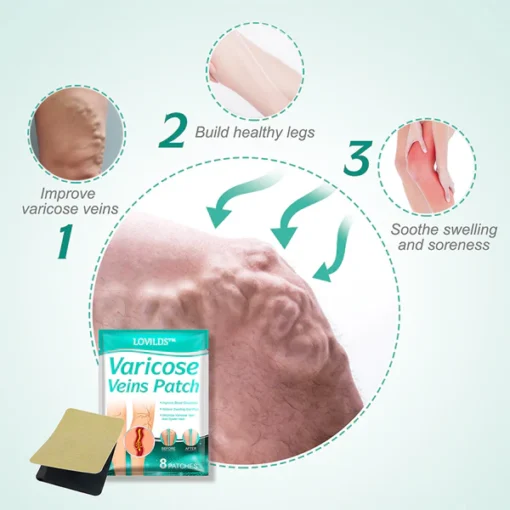 LOVILDS™Leech Varicose Veins Patch