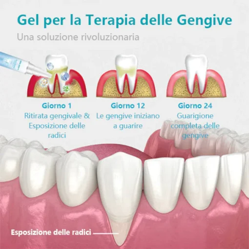 NESLEMY™ Gum Therapy Gel