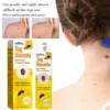 BOOMOON Bee Venom Wart Treatment Spray