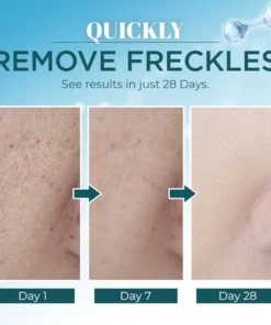 Lanthome™ Triple-Active Brightening Dark Spot Remover