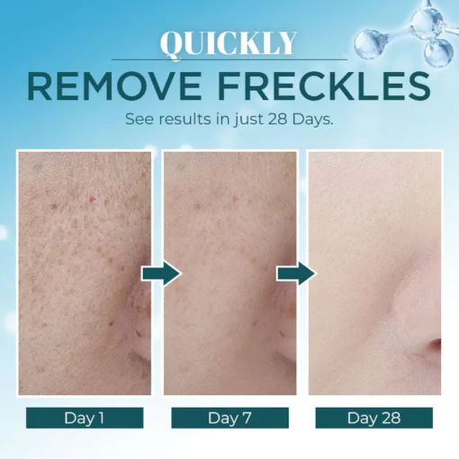 Lanthome™ Triple-Active Brightening Dark Spot Remover