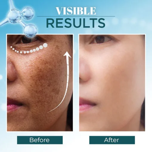 Lanthome™ Triple-Active Brightening Dark Spot Remover