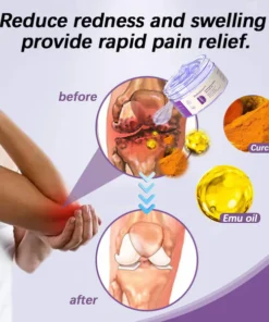 Dobshow® Joint Pain Treatment Gel – Turmeric Extract&Emu Oil
