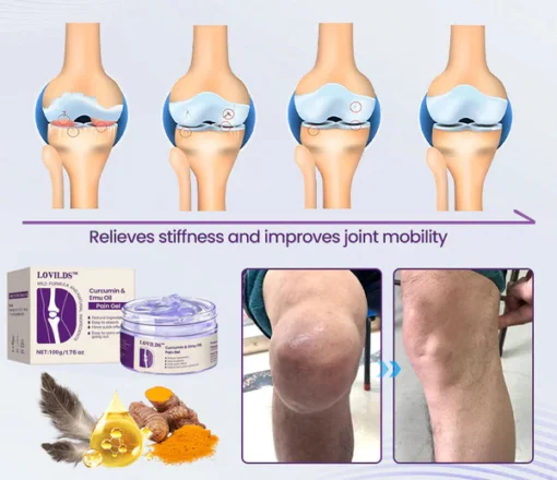 LOVILDS™ Advanced Relief Gel – Formulated by U.S. Experts